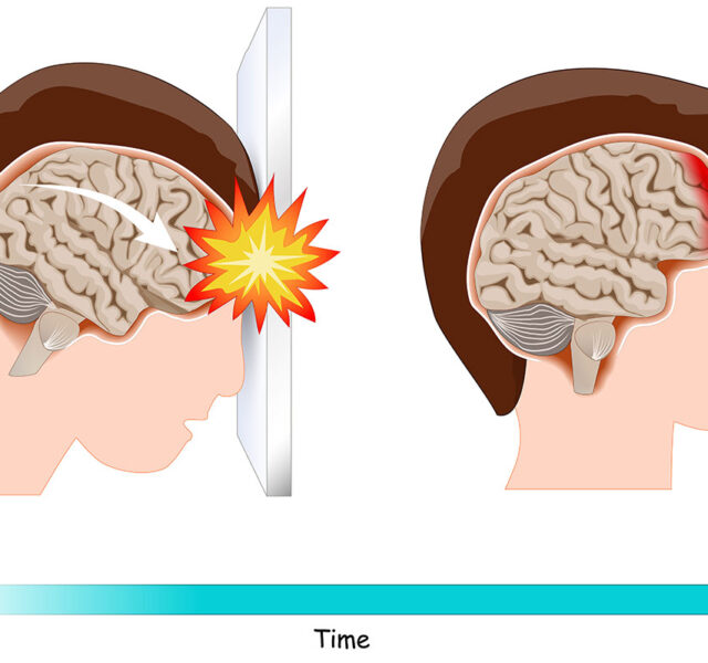 Traumatic Brain Injury