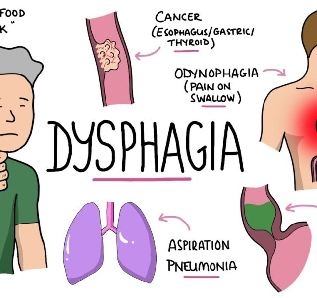 Dysphagia