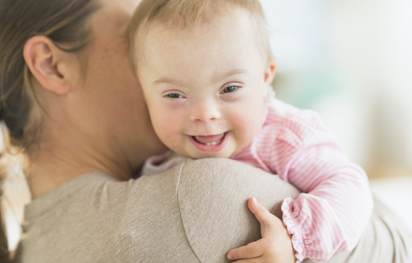 Down’s Syndrome